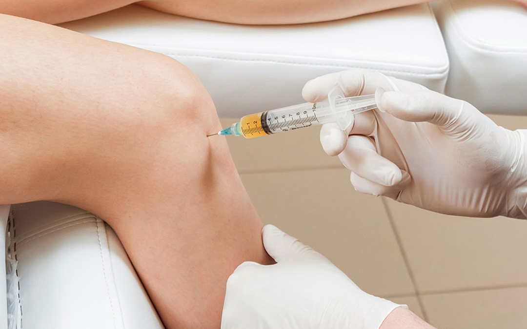 PRP Therapy for Bones Healing