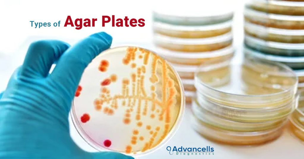Types of Agar Plates