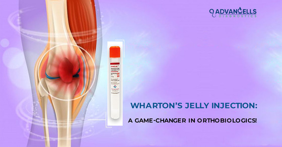 Wharton’s Jelly Injection in Orthobiologics